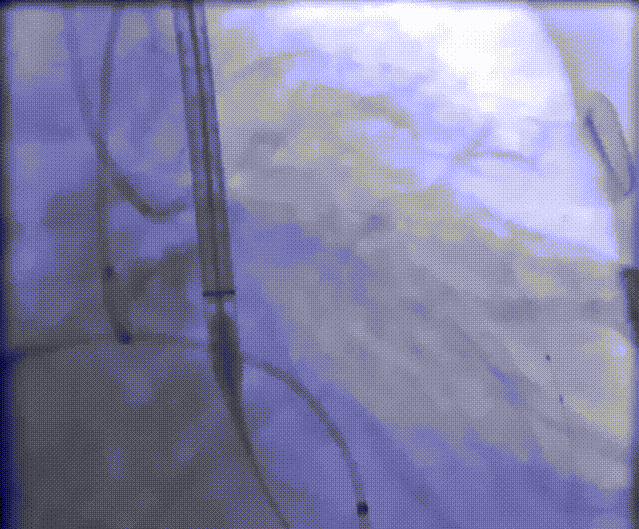 8.gif