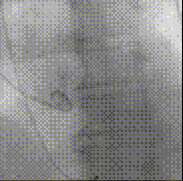9.gif