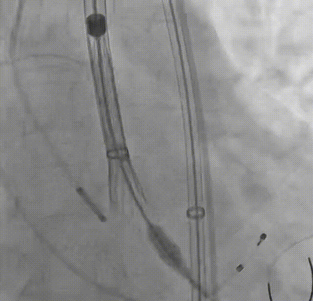 11.gif