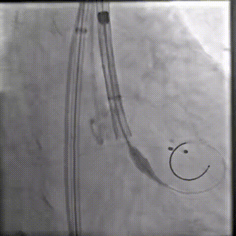 10.gif