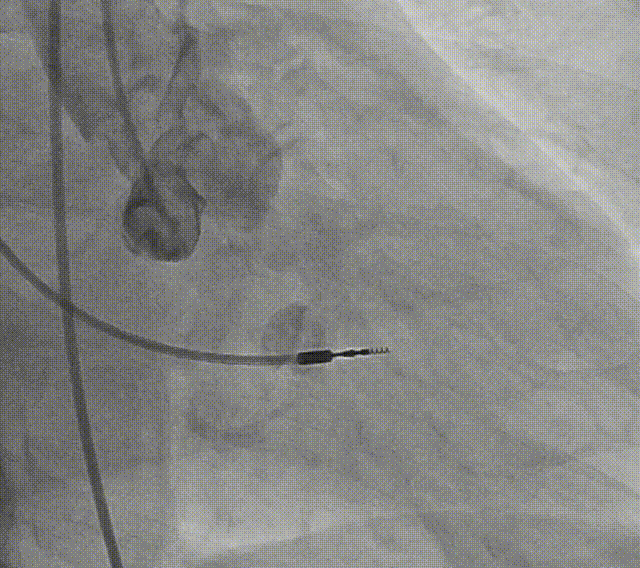 5.gif