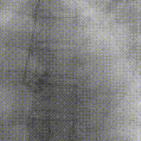 3.gif