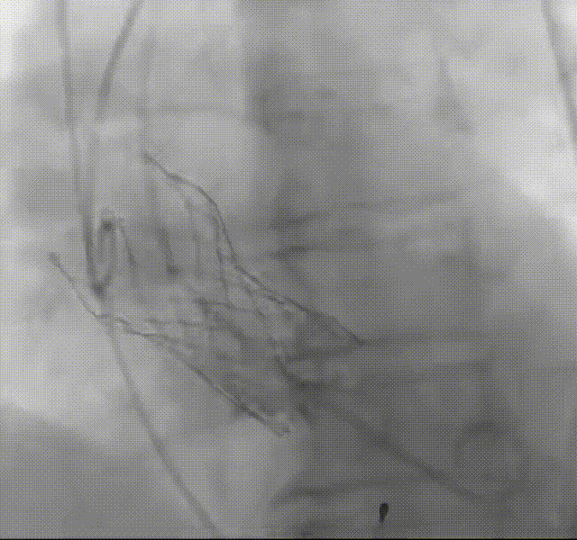 11.gif