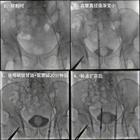 6.gif
