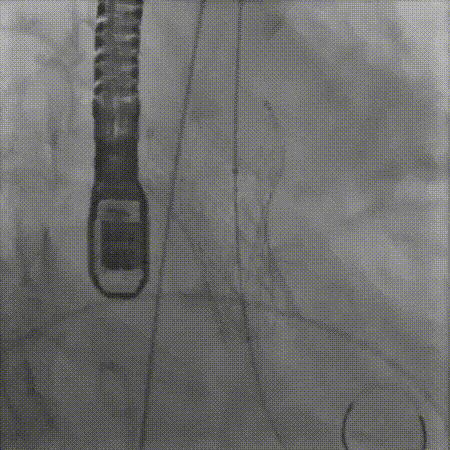 11.gif