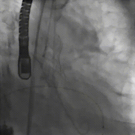 12.gif
