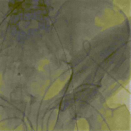13.gif